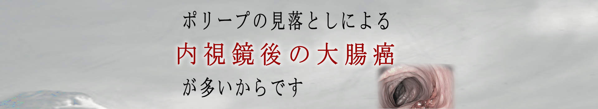 ポリープの見落としによる内視鏡後・大腸癌（PCCRC）が多い